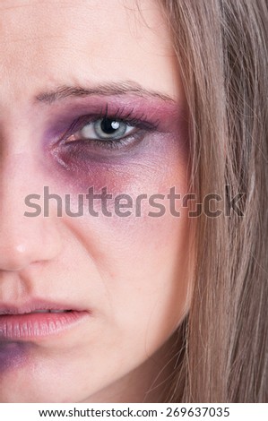 Domestic violence concept with half face of  an injured, beaten and bruised woman victim