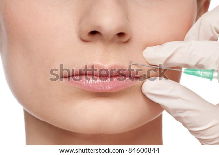 Cosmetic injection in the female face. Lips zone, Isolated