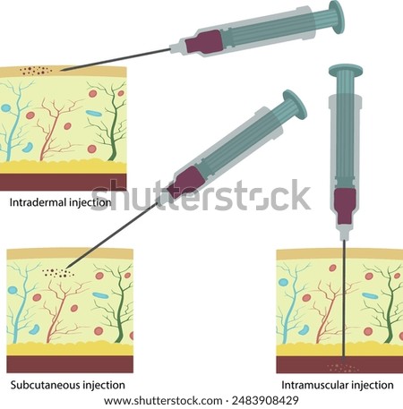 Types of injection. Vaccination. Active immunization.
Intradermal injection
 Subcutaneous injection
Intramuscular injection