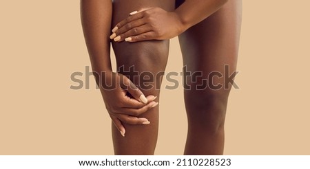 Crop close up of African American woman struggle with acute pain in kneecap. Pain in knee concept. Unwell black biracial female suffer from ache in leg have arthritis or osteoarthrosis. Сток-фото © 