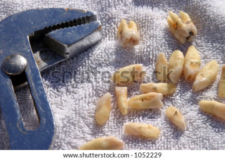 18 extracted human teeth on a white towel with a pair of pliers