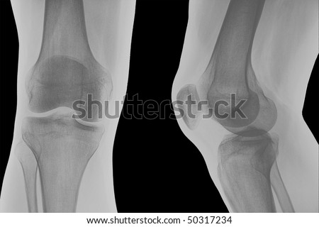 Right knee x-ray shoot.