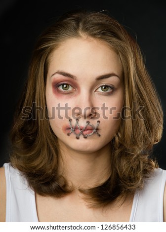 The Girl With The Sewn-Up Mouth. Concept Silence. On Dark Background ...