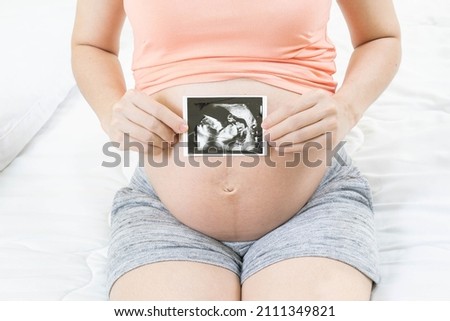 happiness pregnant woman is holding her stomach and a photo of her Ultrasound.Maternity prenatal care and woman pregnancy concept. Imagine de stoc © 