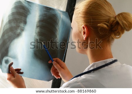 A female doctor examining an x-ray picture, back-view