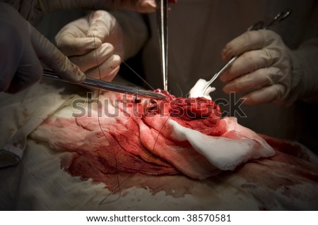Abdominal Surgery. small intestine segment.