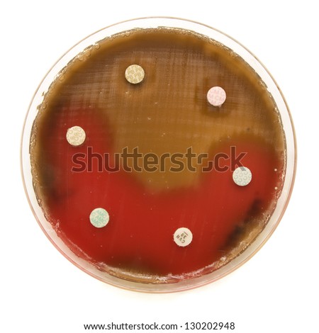 Disk diffusion antimicrobial resistance test on Muller-Hinton agar with blood. Shot on white