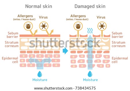 Sectional view of the skin.Comparison illustration of protection effect between healthy skin and wounded skin. With text. 商業照片 © 