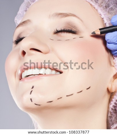Drawn lines on woman's face, marks for facial plastic surgery