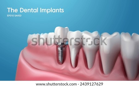 White tooth implant implant cut, healthy tooth or dental surgery.