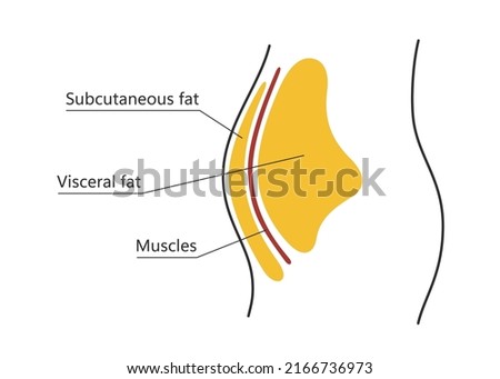 Visceral and subcutaneous fat around waistline. Location of visceral fat in abdominal cavity. Types of human obesity. Medical scheme. Vector illustration isolated on white background.