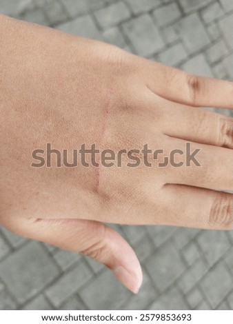 Image, Stock Photo scratch wound on female hand closeup, healthcare and medicine concept