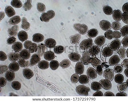 pinworms és echinococcus tabletta férgek nemozol vélemények