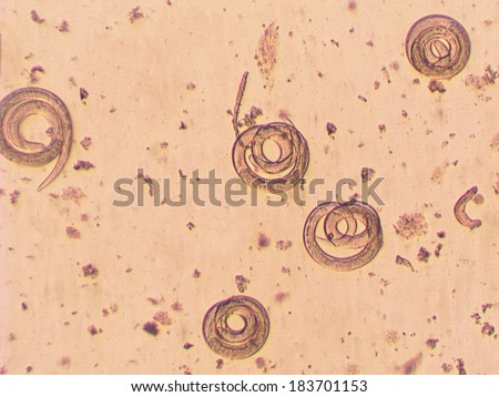 Trichinella spiralis - parasitic worm microscope