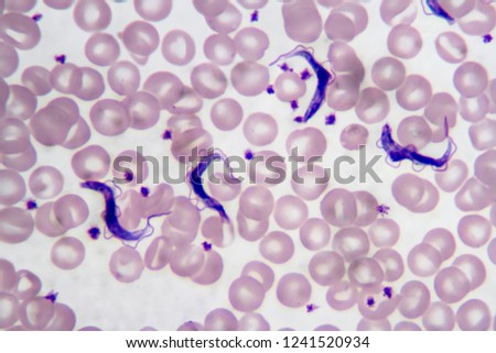 trypanosoma gambiense labeled
