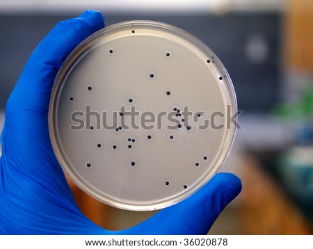 Food poisoning bacteria Staphylococcus aureus growing on an agar plate.