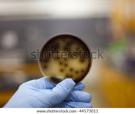 Culture of bacteria on a petri plate being examined.