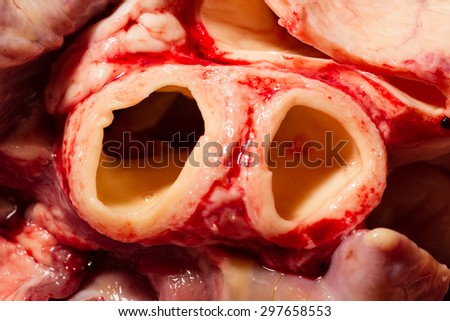 CLOSE UP VIEW OF CATTLE HEART BLOOD ARTERIES AFTER LESS THAN MINUTES FROM ANIMAL DEATH