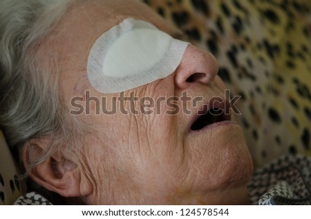 senior person who had eye operation