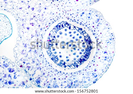 Section  of a lily anther showing developing pollen grains, chromosomes and plant cells.  Magnification X100