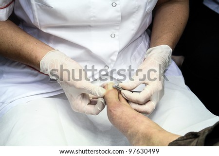 MOSCOW - OCTOBER 26: Correction of ingrown nails at the international exhibition of professional cosmetics and beauty salon equipment INTERCHARM on October 26, 2011 in Moscow