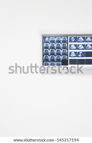 X-rays and ultra sound results hanging on wall