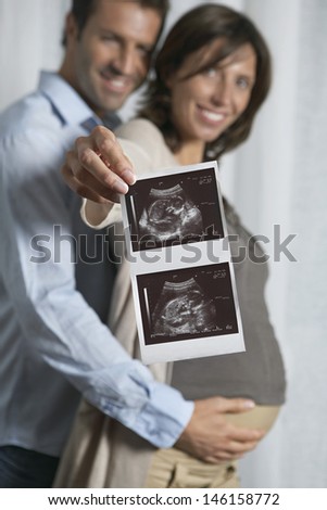 Man embracing woman as she holds up ultrasound scan photo of baby