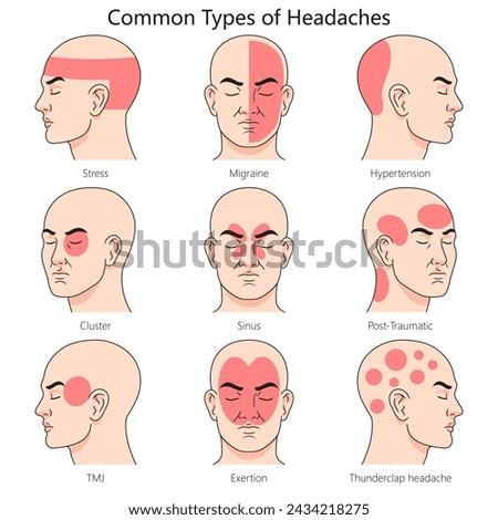 Human headache type structure diagram hand drawn schematic vector illustration. Medical science educational illustration