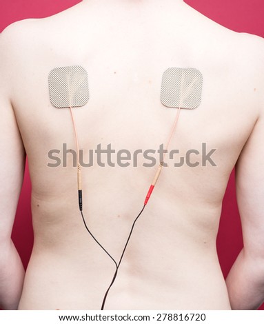 Woman getting Transcutaneous Electrical Nerve Stimulation (TENS) therapy, with two neurostimulation electrodes on her back. Photographed with studio lighting in front of a red backdrop.