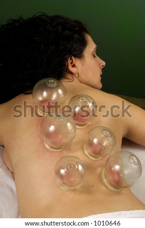 Cupping Gua Sha  at Mind and Body Boutique