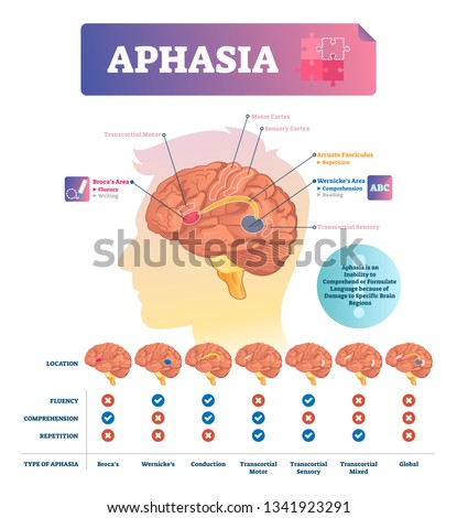 Aphasia vector illustration. Labeled educational scheme with brain neuron disorder. Medical problem with writing, reading and repetition inability. List with illness location, structure and effects.