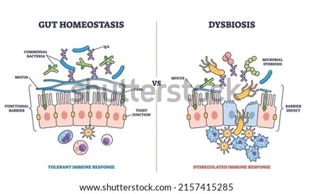 Gut homeostasis and dysbiosis immune response differences outline diagram. Labeled educational scheme with functional barrier and defect side view vector illustration. Tolerant and dysregulated flora.