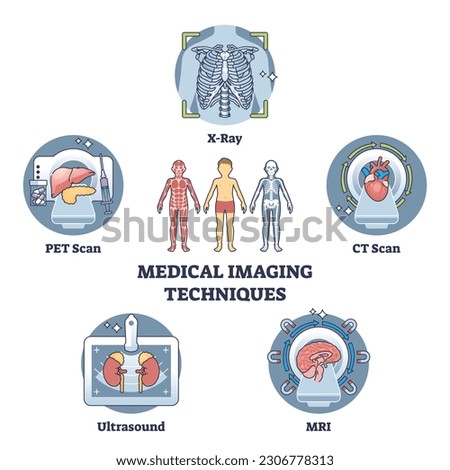 Medical imaging techniques for medical body diagnostics outline diagram. Labeled educational scheme with types for bones or organs inner examination vector illustration. X-ray, CT scan or MRI record.