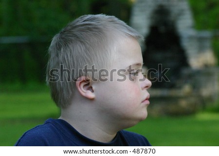 Young Boy with Down Syndrome Profile