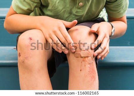 Child with scrapped knee and band aids appied