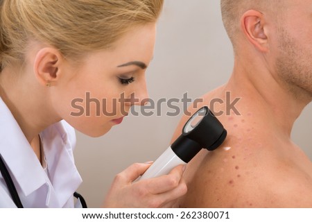 Female Doctor Examining Pigmented Skin With Dermatoscope