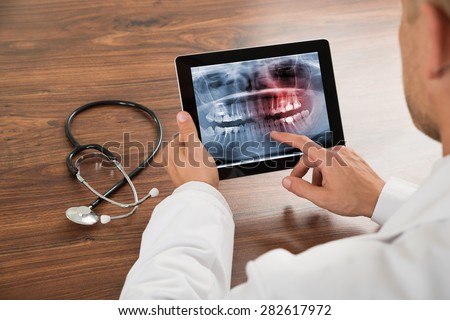 Close-up Of Doctor Looking At Human Teeth X-ray On The Digital Tablet