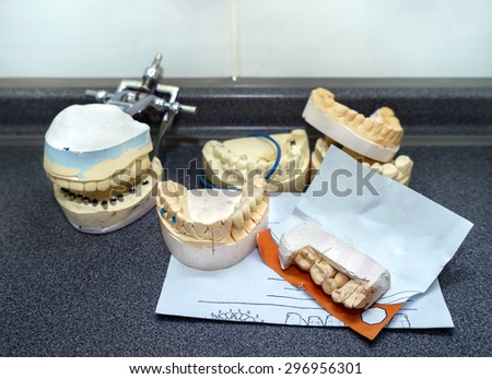 Dental molds and models with prosthetic teeth for cermet in the dental lab