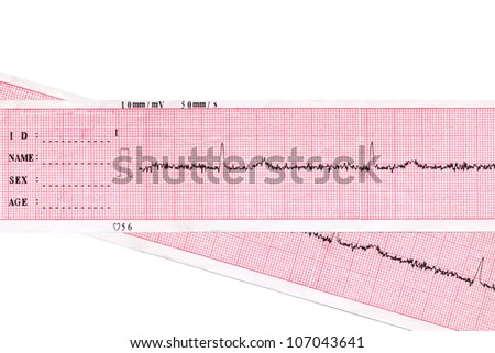 Heart. Medical inspection and health. Heart analysis scheme. Cardiogram