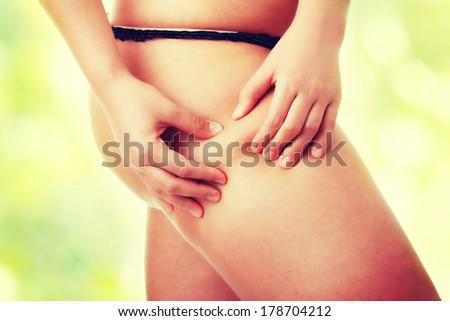 Woman pinching leg for skin fold test