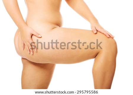 Fat women legs with overweight