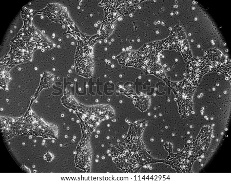 Human neural precursor cells in culture. These cells can later differentiate into neurons, glial cells, etc. View through an inverted biological phase contrast microscope with 400x mag.