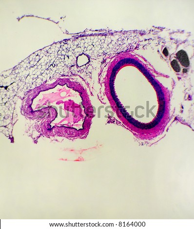 Artery And Vein Cross Sections Showing Differences Between The Two ...