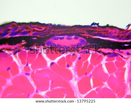 A poison gland in the skin of a salamander.  Very high power microscopic view.