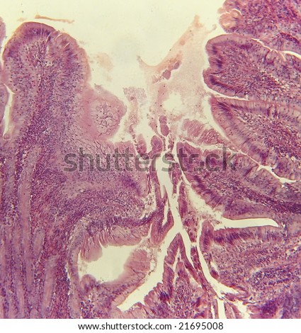 Microscopic cross section of the duodenum portion of the wall of the ...