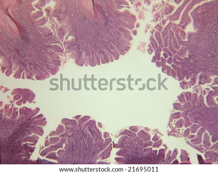 Microscopic cross section of the duodenum portion of the wall of the small intestine showing villi.