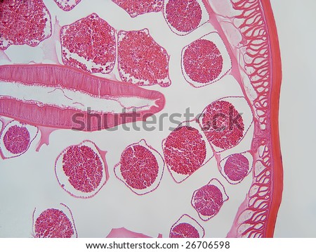 Male Ascaris Parasitic Roundworm, Cross Section, Showing Important ...