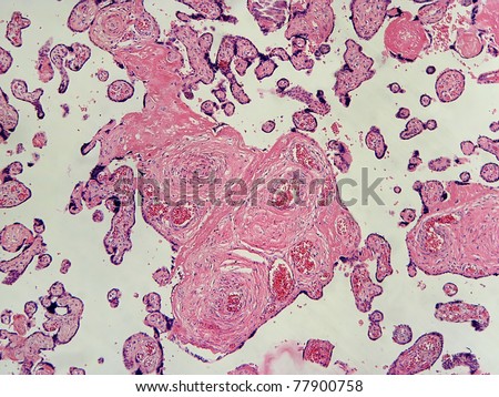 Human Placenta at the stage of Mature Placental Pattern in late term pregnancy.  The placenta tissue at this late stage exhibits multiple well developed vessels. Magnification 100x