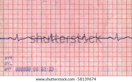 cardiovascular diagram closeup. cardio diagnostic results of patient. healthcare measuring visualization, medical pulse background