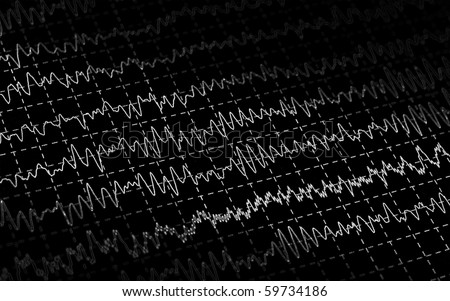 EEG: MedlinePlus Medical Encyclopedia - National Library of